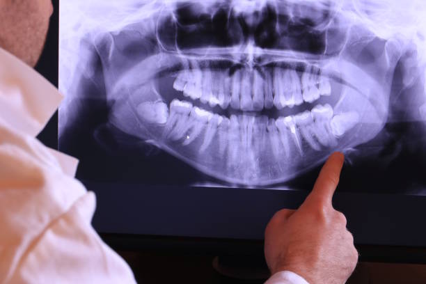 Best Emergency Tooth Extraction in Lake Barrington, IL